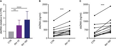 Human neutrophil extracellular traps do not impair in vitro Toxoplasma gondii infection